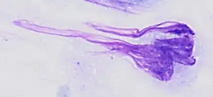 Pap stained smear of a monocyte with nuclear smearing or smudging artifact, seen as a tail-like extension of nuclear material.